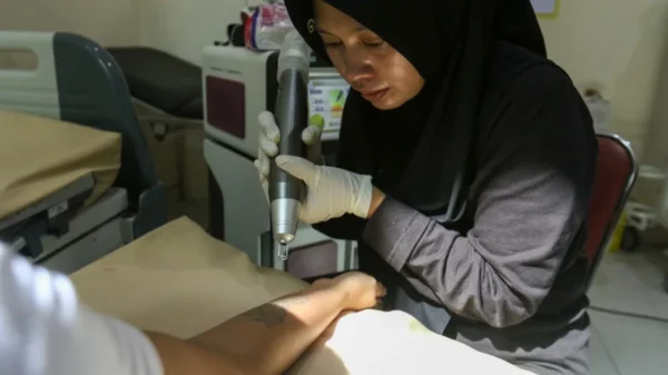 Program Hapus Tato Gratis, Mulai Wanita hingga Lansia Serbu Klinik